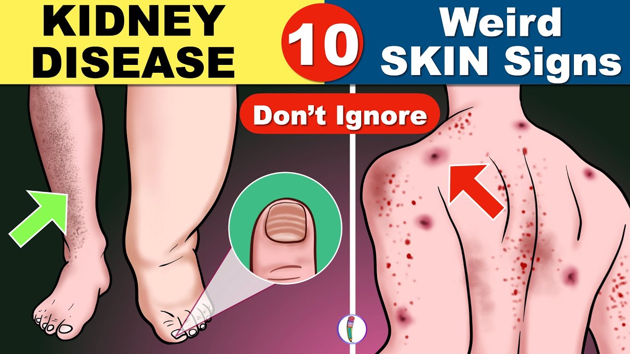Swelling in Ankles, Feet, and Face 